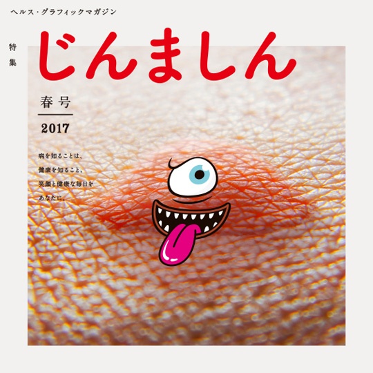 ヘルス・グラフィックマガジン Vol.25「じんましん」