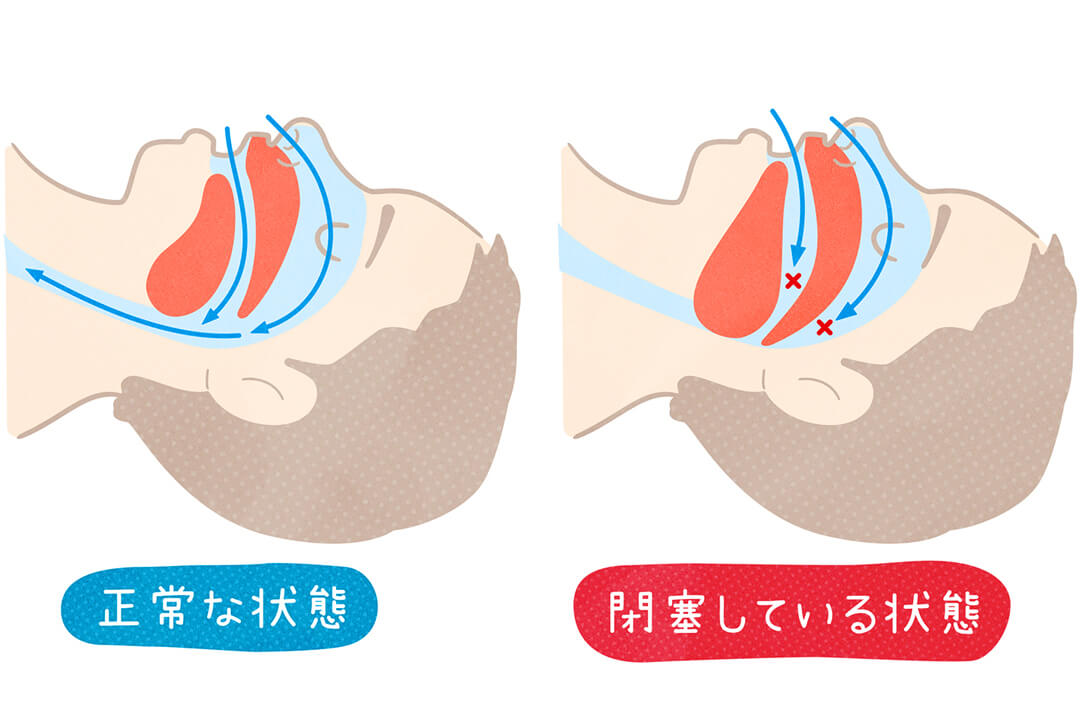 series-menshealthcare-suiminjimukokyu-cut01