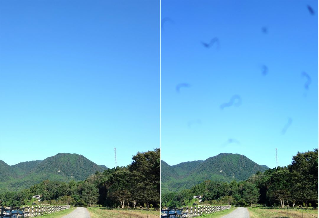 早期発見が大事！気をつけたい目のトラブル・病気