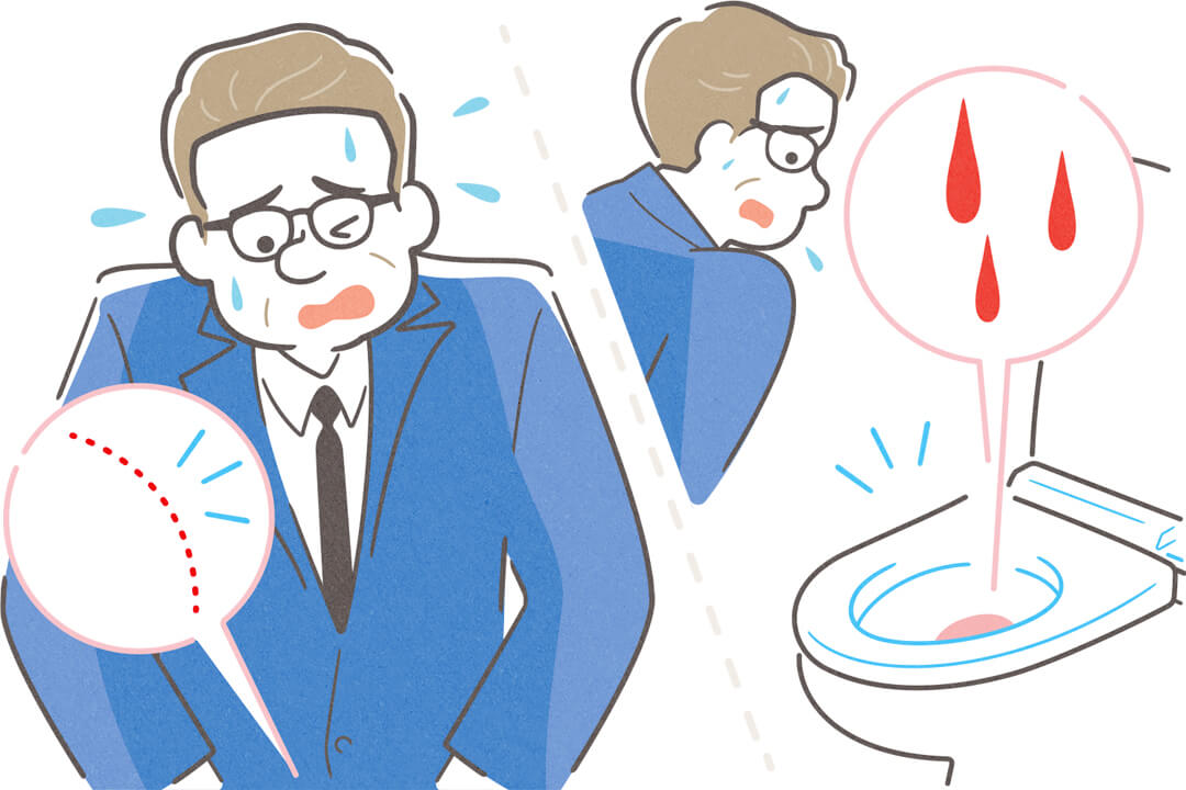 series-menshealthcare-nyokankesseki-cut02