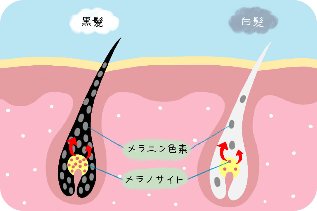 series-hairtrouble-siraga-cut01