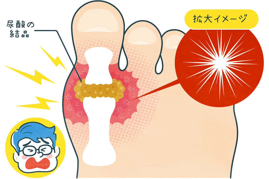 series-menshealthcare-tsuuhuui-cut01