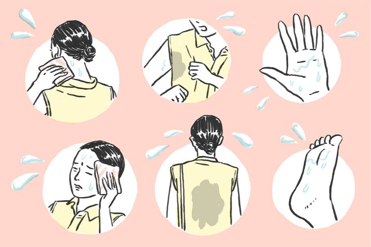 大量の汗が止まらない…「多汗症」の症状や治療法は？