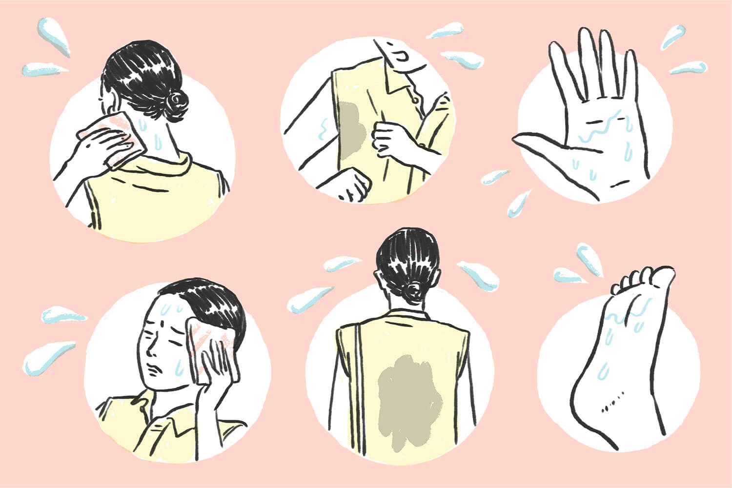 大量の汗が止まらない…「多汗症」の症状や治療法は？