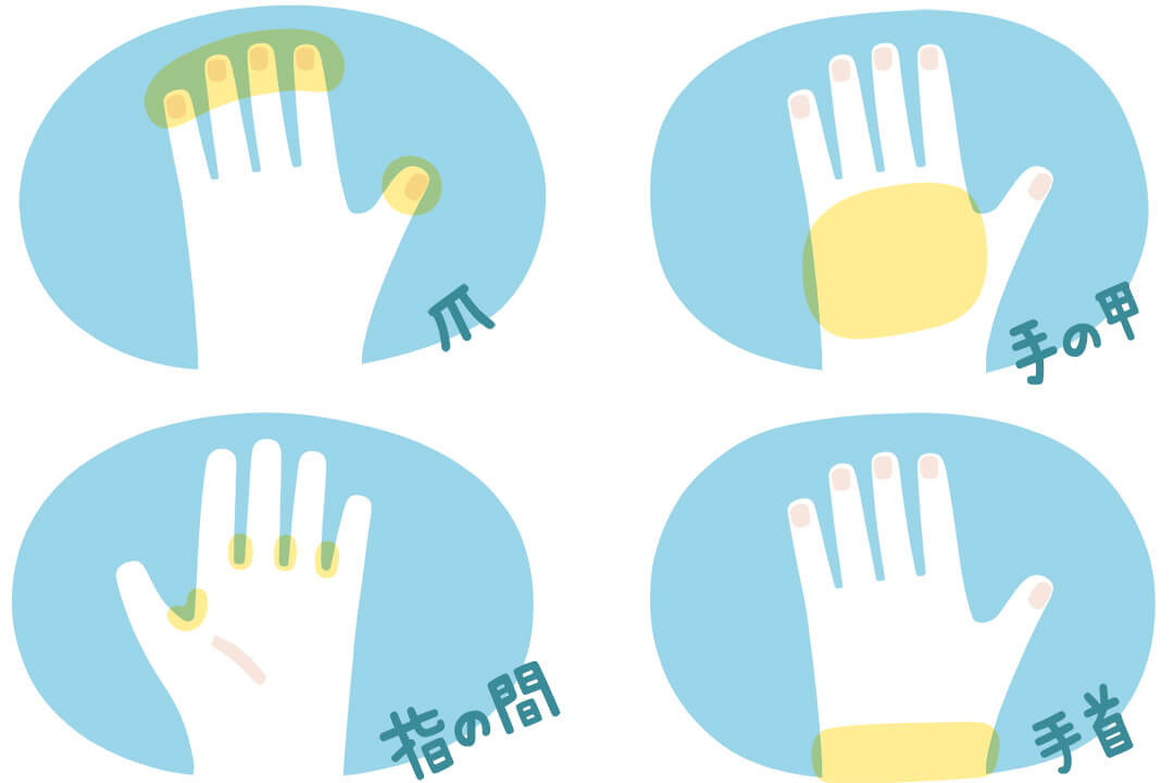 子どもの手荒れ予防。正しい手洗い・消毒・ハンドケア