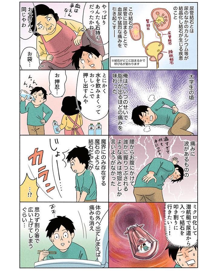 宮川サトシの体験記「俺は尿管結石が捨てられない」