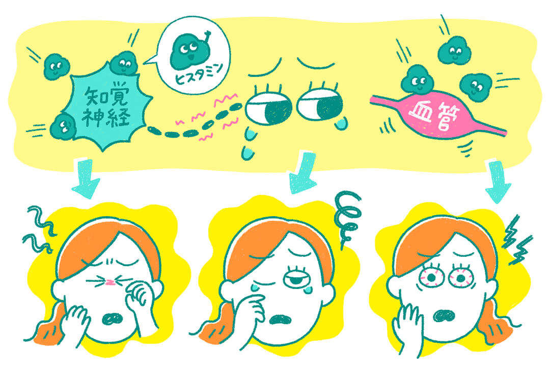 どうする？つらい目のかゆみ。眼科医に聞く目の労り方