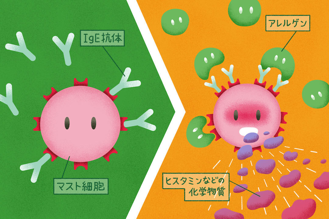アレルギーはなぜ起こる？発症のメカニズムを知ろう