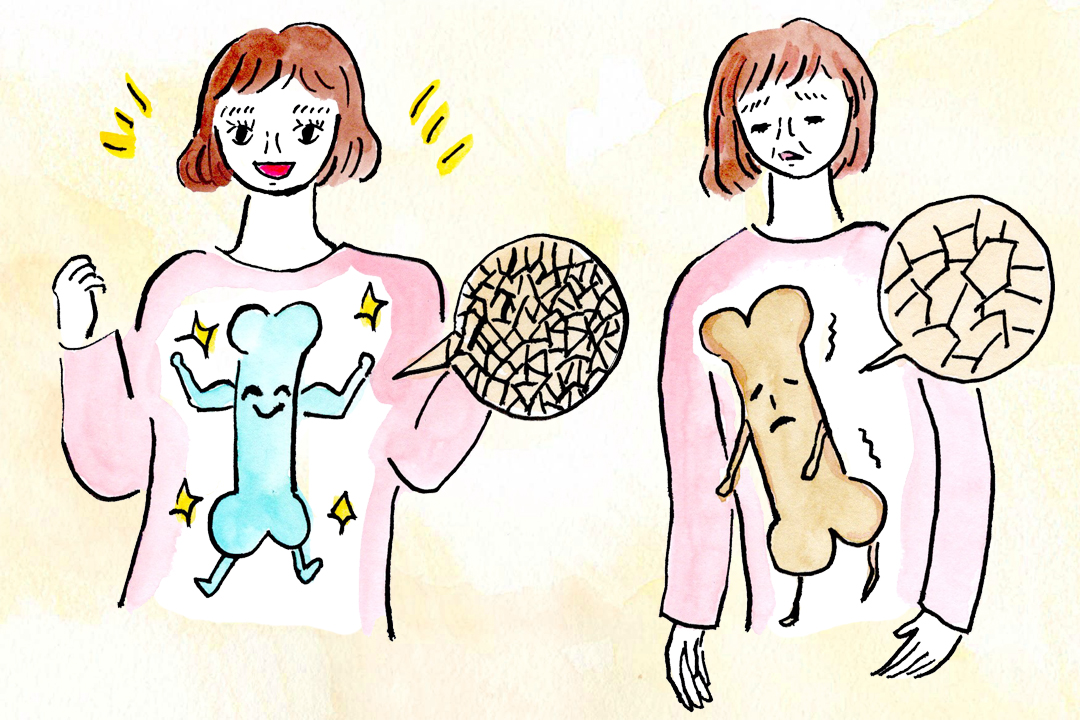 すべての女性が気をつけたい「骨粗しょう症」