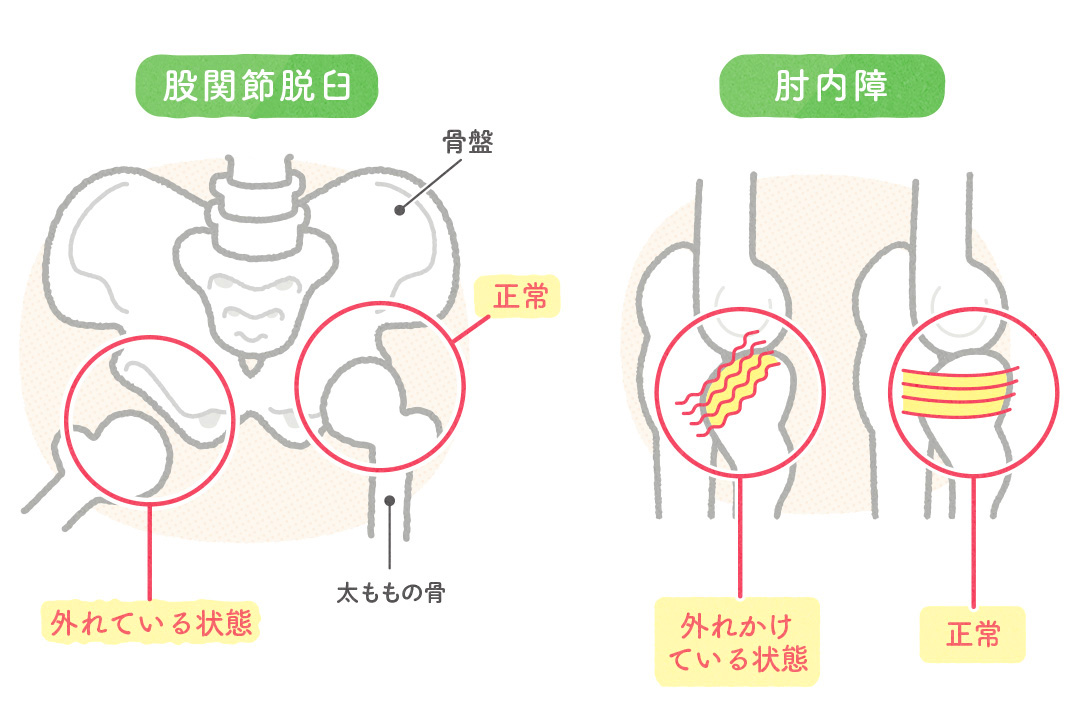 ゆりかごから墓場まで？「年代別」骨と筋肉のトラブル