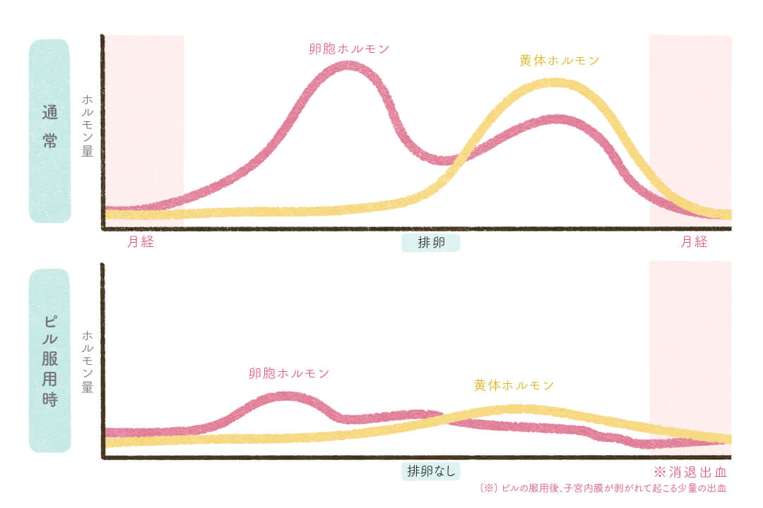 鎮痛薬、ピル、ミレーナ…我慢しない生理痛の対処法