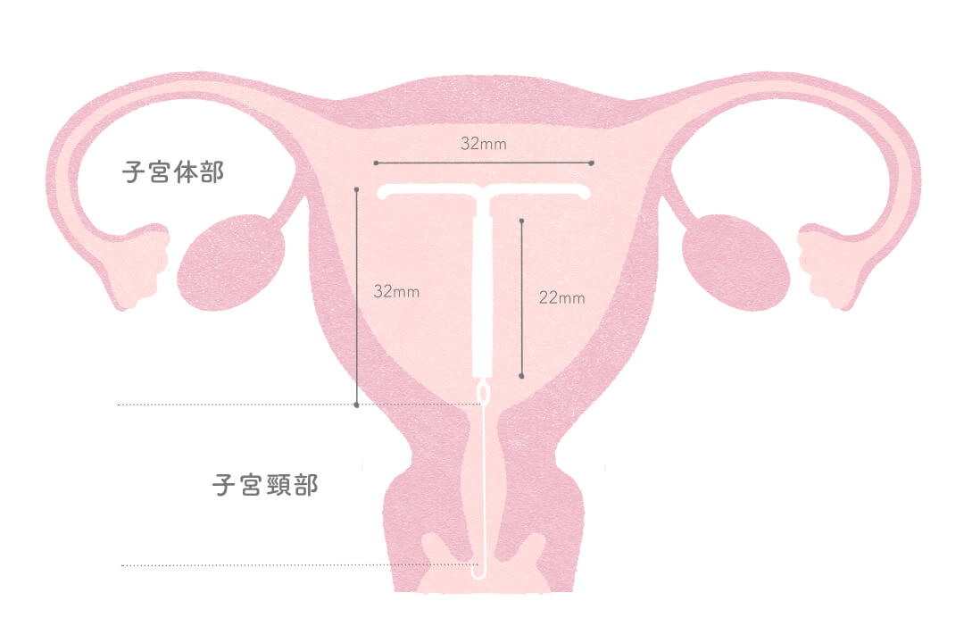 鎮痛薬、ピル、ミレーナ…我慢しない生理痛の対処法