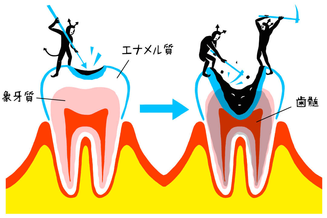 全身の健康に影響が!? 忘れず受けたい「歯」の健診
