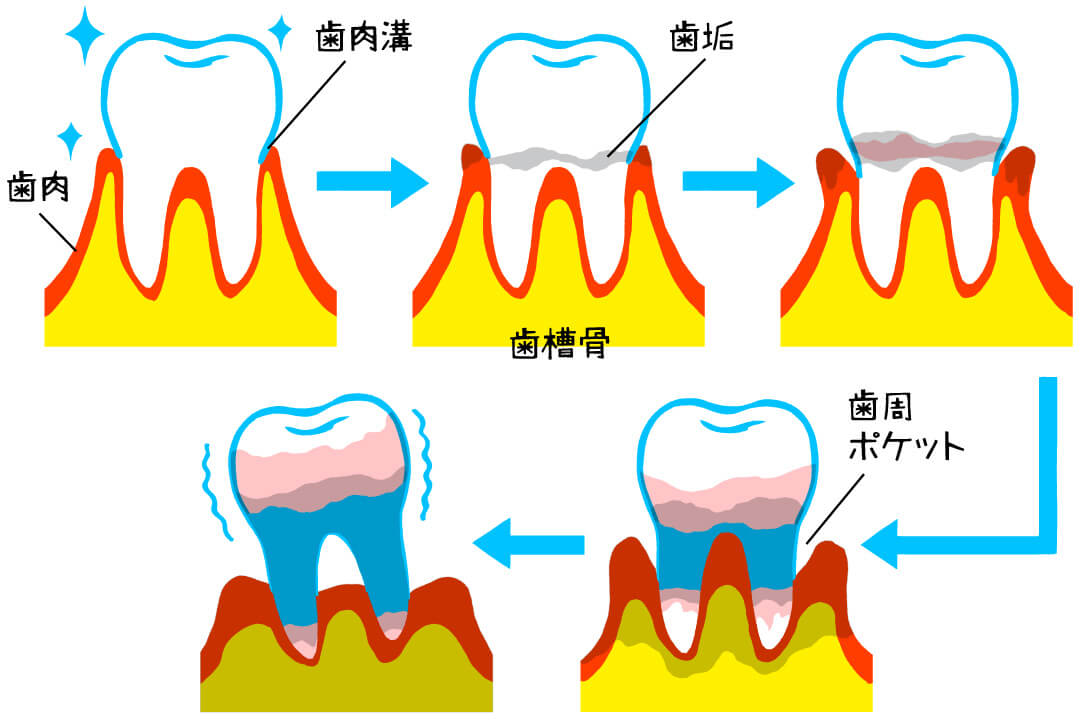 全身の健康に影響が!? 忘れず受けたい「歯」の健診