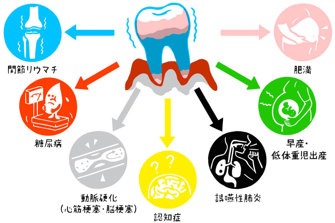 全身の健康に影響が!? 忘れず受けたい「歯」の健診