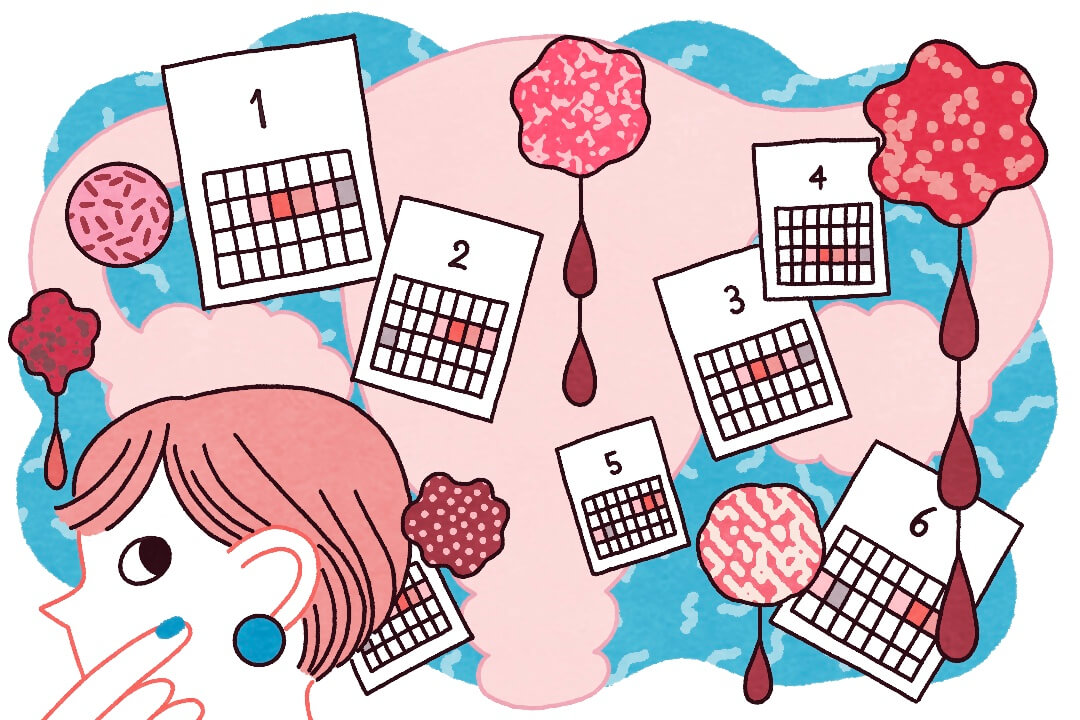 何かのサイン？生理の不調に隠れる病気