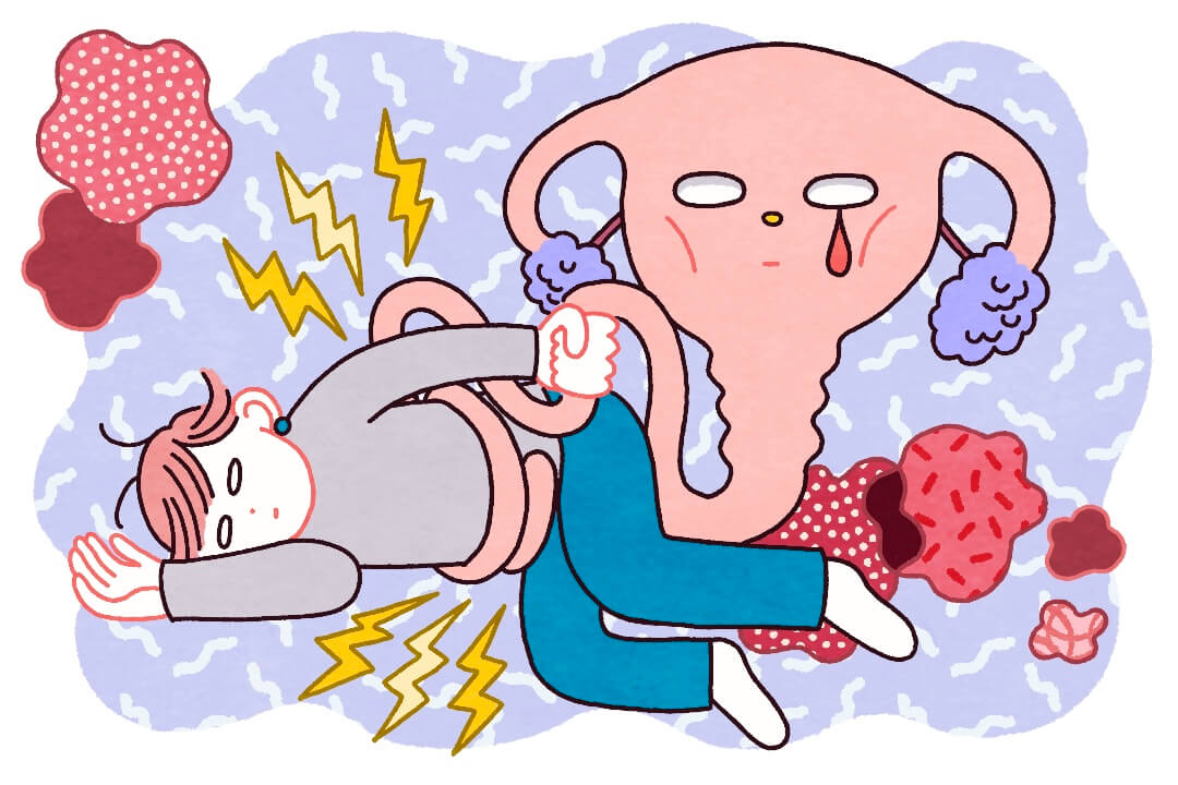 何かのサイン？生理の不調に隠れる病気