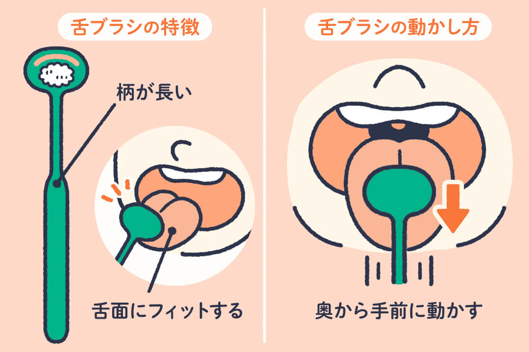 ケア不足？病気のサイン？口臭の種類と原因を解説