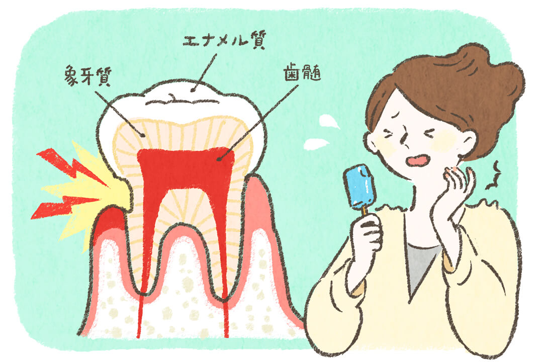 虫歯や口臭だけじゃない！よくある口腔トラブルって？