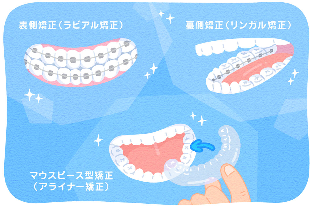 子どもと大人の矯正歯科治療。知っておくべきポイント