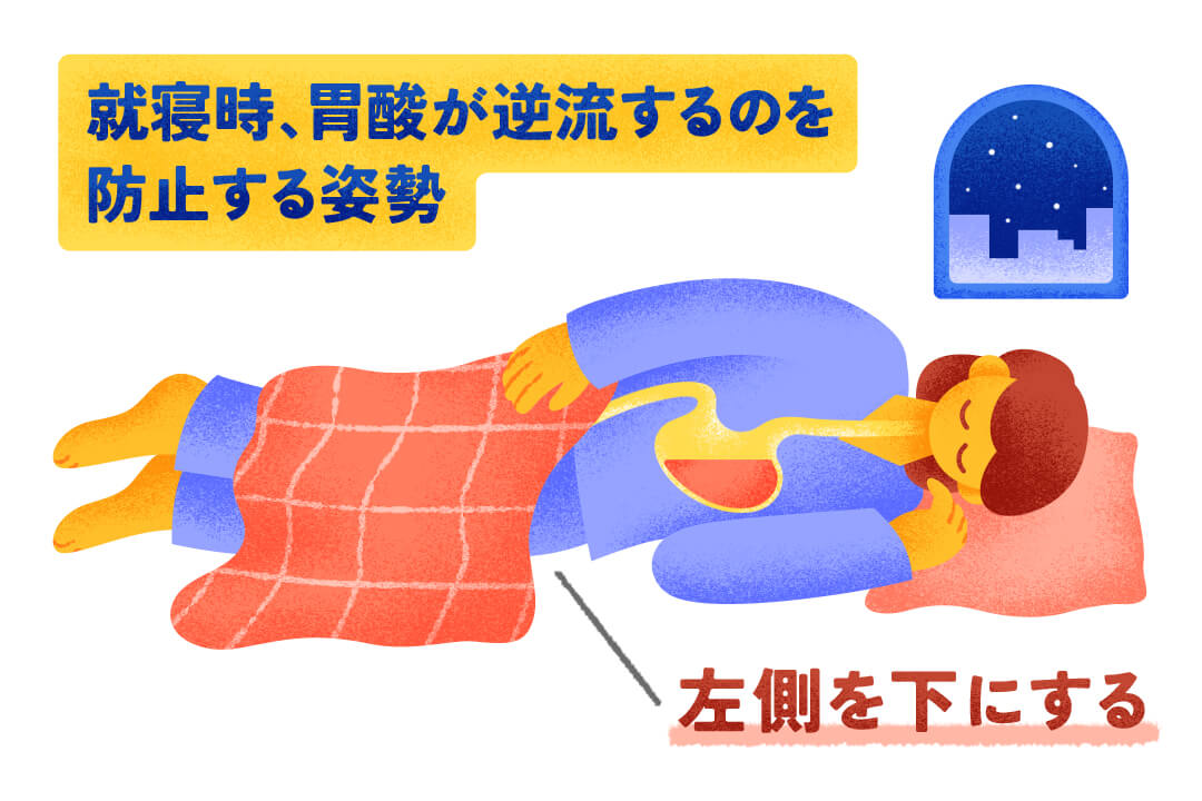 近年増加中！咳の原因にもなる「逆流性食道炎」